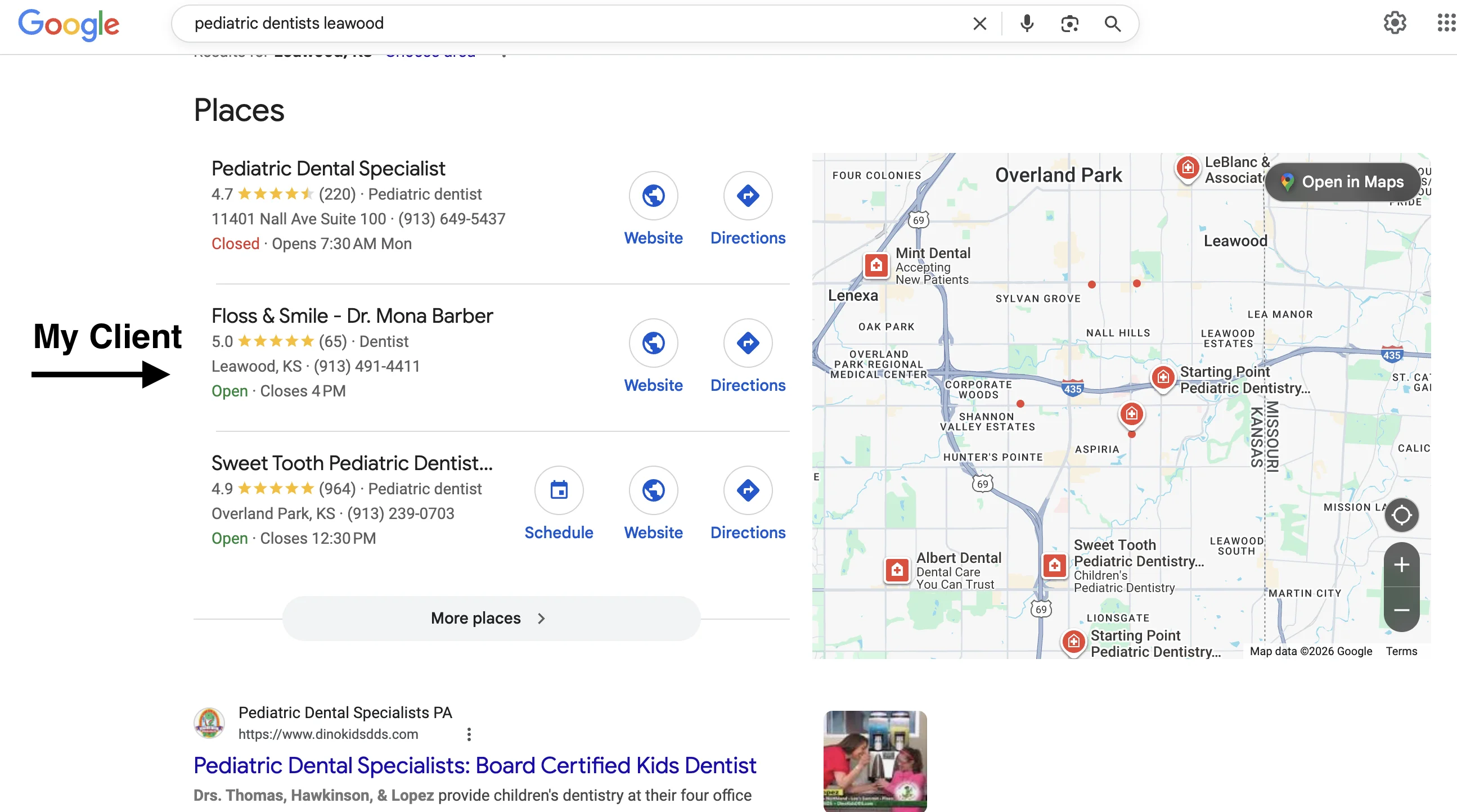 Google search results showing #2 ranking for leawood dentist