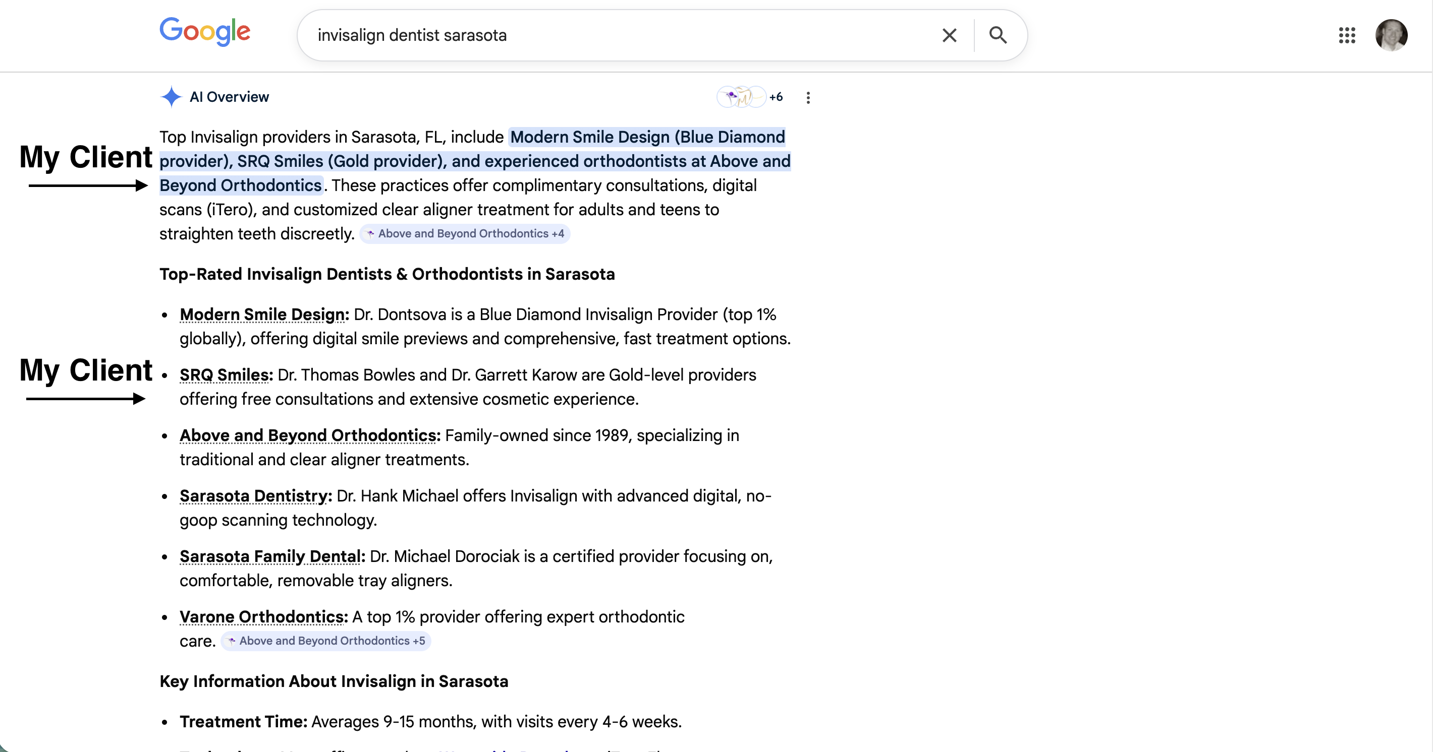 Google AI Overview featuring SRQ Smiles as a top Invisalign provider in Sarasota