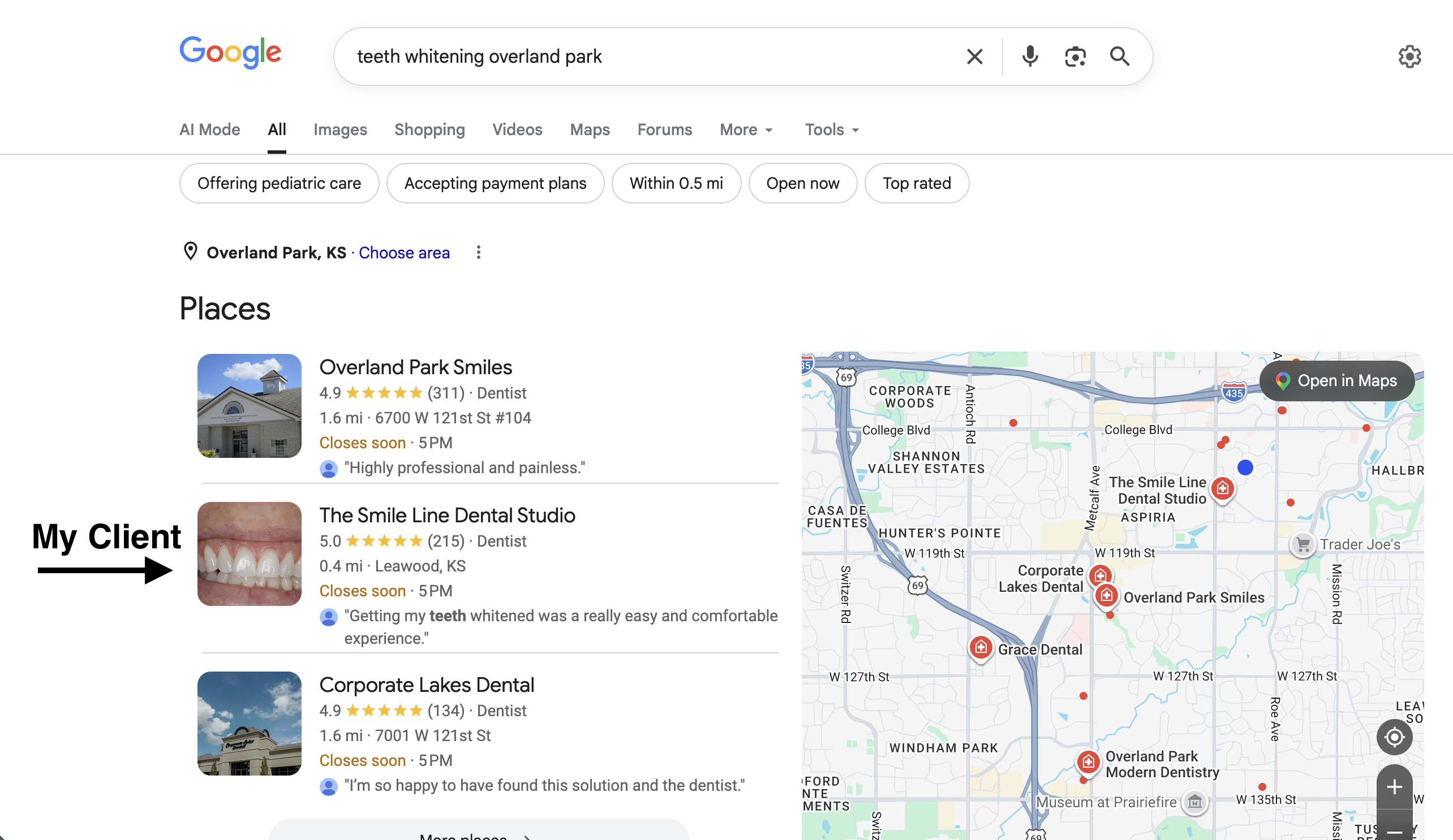 Client ranking for teeth whitening Overland Park